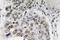 SMAD Family Member 6 antibody, LS-C177614, Lifespan Biosciences, Immunohistochemistry paraffin image 