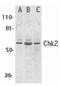 Checkpoint Kinase 2 antibody, PA5-19971, Invitrogen Antibodies, Western Blot image 