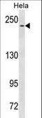 Notch Receptor 3 antibody, LS-C158409, Lifespan Biosciences, Western Blot image 