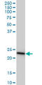 RAS Related 2 antibody, LS-B4517, Lifespan Biosciences, Western Blot image 