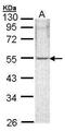 Rho GTPase Activating Protein 1 antibody, PA5-27426, Invitrogen Antibodies, Western Blot image 