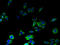 Major Facilitator Superfamily Domain Containing 8 antibody, A66782-100, Epigentek, Immunofluorescence image 