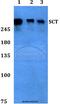 Secretin antibody, A08899, Boster Biological Technology, Western Blot image 