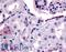 Erb-B2 Receptor Tyrosine Kinase 4 antibody, LS-A2846, Lifespan Biosciences, Immunohistochemistry paraffin image 