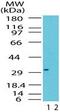 Retina And Anterior Neural Fold Homeobox antibody, PA1-41388, Invitrogen Antibodies, Western Blot image 