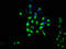 Integral Membrane Protein 2B antibody, LS-C672773, Lifespan Biosciences, Immunofluorescence image 