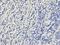 RAD52 Homolog, DNA Repair Protein antibody, orb136222, Biorbyt, Immunohistochemistry paraffin image 