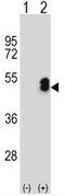 LIM Homeobox Transcription Factor 1 Beta antibody, GTX80930, GeneTex, Western Blot image 