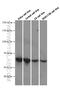 SRC Proto-Oncogene, Non-Receptor Tyrosine Kinase antibody, 60315-1-Ig, Proteintech Group, Western Blot image 