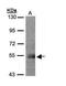 Protein Kinase C And Casein Kinase Substrate In Neurons 1 antibody, PA5-28852, Invitrogen Antibodies, Western Blot image 