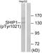 Inositol Polyphosphate-5-Phosphatase D antibody, LS-C199568, Lifespan Biosciences, Western Blot image 