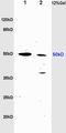 Tubulin antibody, orb100281, Biorbyt, Western Blot image 