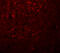 Potassium Two Pore Domain Channel Subfamily K Member 18 antibody, A07164, Boster Biological Technology, Immunofluorescence image 