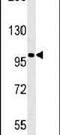 Enhancer Of Polycomb Homolog 2 antibody, PA5-25141, Invitrogen Antibodies, Western Blot image 