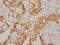 Retinoic Acid Receptor Alpha antibody, CSB-RA019338A0HU, Cusabio, Immunohistochemistry paraffin image 