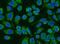 Acyl-CoA Dehydrogenase Medium Chain antibody, A02383-3, Boster Biological Technology, Immunofluorescence image 