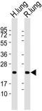 Prosurfactant Protein C antibody, MBS9206337, MyBioSource, Western Blot image 
