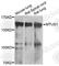 Microtubule Associated Scaffold Protein 1 antibody, A7601, ABclonal Technology, Western Blot image 