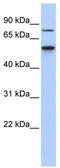 Casein Kinase 1 Gamma 1 antibody, TA329603, Origene, Western Blot image 