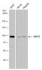 SUZ12 Polycomb Repressive Complex 2 Subunit antibody, GTX130179, GeneTex, Western Blot image 