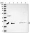 Integrin Subunit Beta 3 Binding Protein antibody, PA5-55865, Invitrogen Antibodies, Western Blot image 