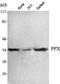 Protein Phosphatase 4 Catalytic Subunit antibody, A06390-1, Boster Biological Technology, Western Blot image 