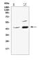 Adenosine Deaminase antibody, A00866-1, Boster Biological Technology, Western Blot image 