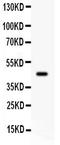 Adrenoceptor Beta 2 antibody, LS-C357557, Lifespan Biosciences, Western Blot image 