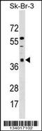 Armadillo Repeat Containing 10 antibody, 60-083, ProSci, Western Blot image 