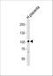 Prolyl 3-Hydroxylase 1 antibody, A06697, Boster Biological Technology, Western Blot image 