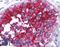 Basigin (Ok Blood Group) antibody, LS-B1950, Lifespan Biosciences, Immunohistochemistry paraffin image 