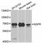 Nerve Growth Factor Receptor antibody, STJ113724, St John