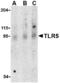 Toll Like Receptor 5 antibody, TA306269, Origene, Western Blot image 