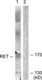 Ret Proto-Oncogene antibody, PA5-38509, Invitrogen Antibodies, Western Blot image 
