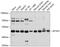 Adaptor Related Protein Complex 1 Subunit Mu 1 antibody, GTX64907, GeneTex, Western Blot image 