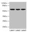 K10 antibody, CSB-PA012504LA01HU, Cusabio, Western Blot image 