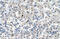 Cerebellar Degeneration Related Protein 2 antibody, 30-707, ProSci, Immunohistochemistry paraffin image 