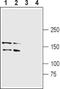 Leucine Rich Repeat Kinase 1 antibody, PA5-77530, Invitrogen Antibodies, Western Blot image 