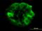 GATA Zinc Finger Domain Containing 2B antibody, orb89683, Biorbyt, Immunofluorescence image 