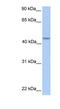 Patatin Like Phospholipase Domain Containing 5 antibody, NBP1-70680, Novus Biologicals, Western Blot image 