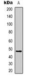 Serpin Family A Member 3 antibody, abx133770, Abbexa, Western Blot image 