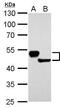 Keratin 13 antibody, PA5-22065, Invitrogen Antibodies, Western Blot image 