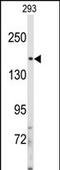 Insulin Receptor Substrate 2 antibody, A00805-1, Boster Biological Technology, Western Blot image 