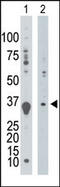 Deoxyguanosine kinase, mitochondrial antibody, AP13670PU-N, Origene, Western Blot image 