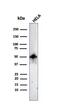 Forkhead Box A1 antibody, GTX02640, GeneTex, Western Blot image 