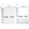 NAD(P)HX Epimerase antibody, NBP2-30943, Novus Biologicals, Western Blot image 