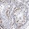 Methyl-CpG Binding Protein 2 antibody, NBP1-81028, Novus Biologicals, Immunohistochemistry paraffin image 