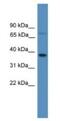 Olfactory Receptor Family 1 Subfamily S Member 1 (Gene/Pseudogene) antibody, NBP1-69090, Novus Biologicals, Western Blot image 