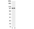 Erythrocyte Membrane Protein Band 4.1 Like 1 antibody, R31390, NSJ Bioreagents, Western Blot image 