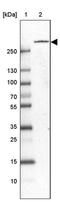 Plexin B1 antibody, PA5-59211, Invitrogen Antibodies, Western Blot image 